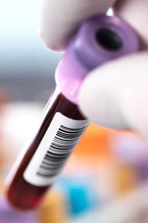 Blood Type Test